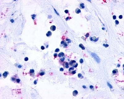 Anti-CYSLTR1 (Extracellular Domain) Antibody