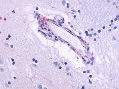 Anti-CHRM5 (Cytoplasmic Domain) Antibody