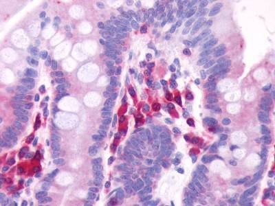 Anti-GPR39 (Extracellular Domain) Antibody