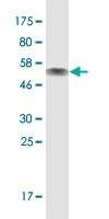 Anti-ZNF511 Antibody