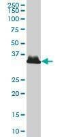 Anti-AKR1B10 Antibody