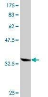 Anti-AKR1B10 Antibody