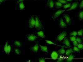 Anti-ZNF622 Antibody