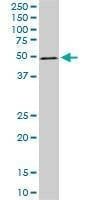 Anti-ZNF622 Antibody