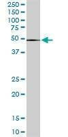 Anti-ZNF622 Antibody