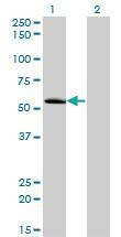 Anti-ZNF622 Antibody