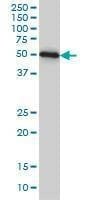 Anti-ZNF622 Antibody