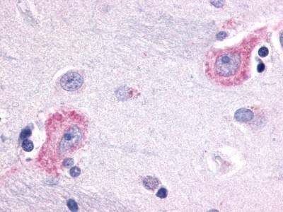 Anti-Encephalopsin (C-term) Antibody