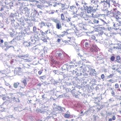 Anti-PTHR2 / PTH2R (Extracellular Domain) Antibody