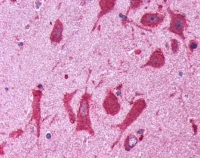 Anti-CB1 (Cytoplasmic Domain) Antibody