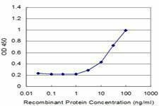 Anti-ZNF70 Antibody