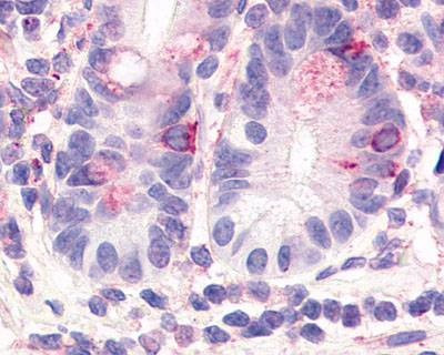 Anti-HNF4 Gamma (Internal) Antibody