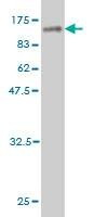 Anti-ZNF96 Antibody