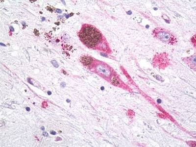 Anti-MC1R (Cytoplasmic Domain) Antibody