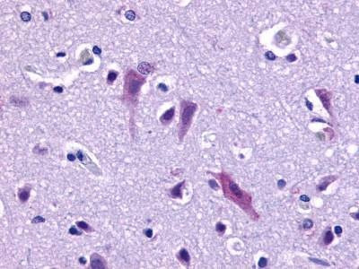 Anti-QRFPR / GPR103 (Extracellular Domain) Antibody