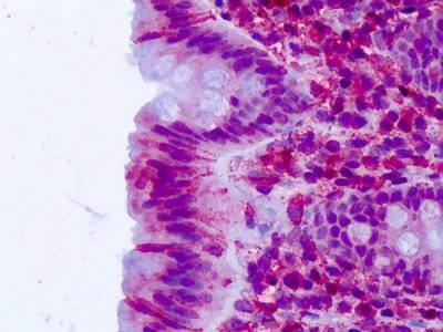 Anti-CELSR2 (N-term) Antibody