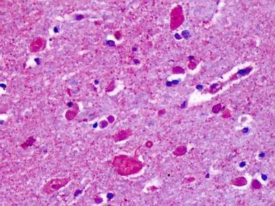 Anti-CELSR2 (N-term) Antibody