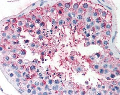 Anti-FSH Receptor / FSHR (N-term) Antibody