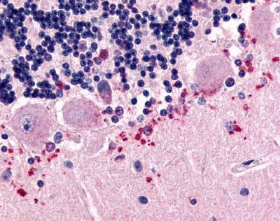 Anti-CELSR3 (N-term) Antibody