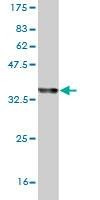 Anti-ZW10 Antibody