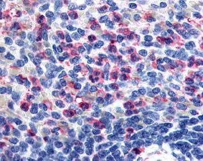 Anti-GPR43 (Extracellular Domain) Antibody