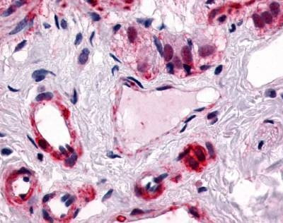 Anti-CALCRL / CRLR (Cytoplasmic Domain) Antibody