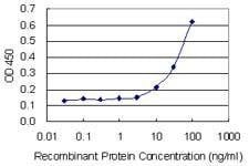 Anti-AKR1CL1 Antibody