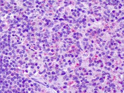 Anti-CCR7 (C-term) Antibody
