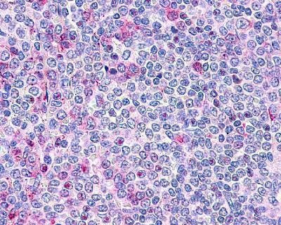 Anti-P2Y10 / P2RY10 (Extracellular Domain) Antibody