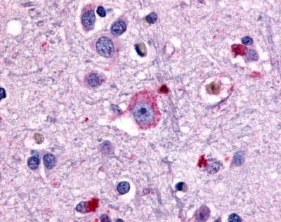 Anti-GRM1 / MGLUR1 (N-term) Antibody