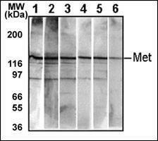 Anti-MET/HGFR Antibody