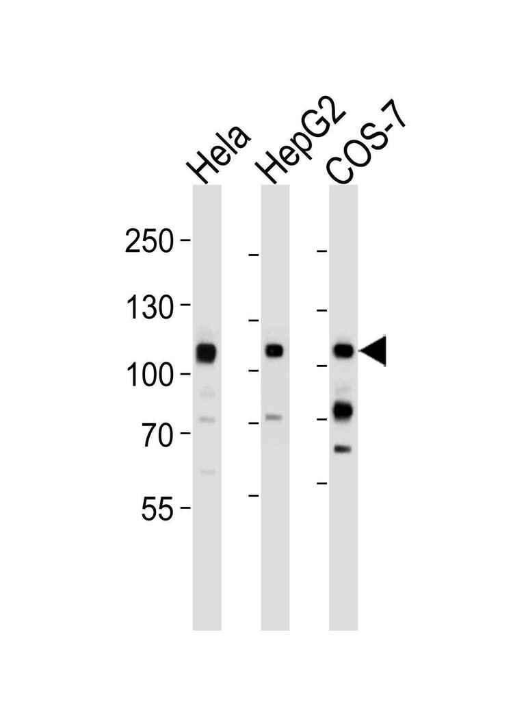 Anti-MET/HGFR Antibody
