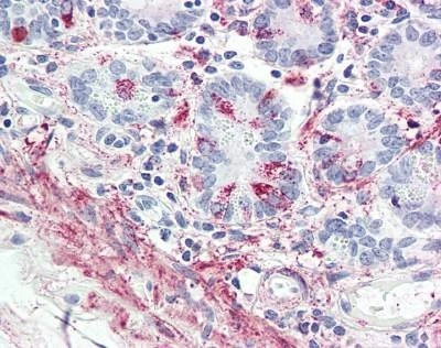 Anti-Glp-2 / GLP2R (Internal) Antibody