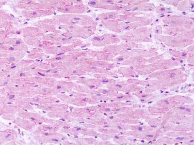 Anti-Neurokinin 1 Receptor (C-term) Antibody
