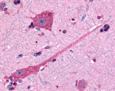 Anti-Dopamine D2 Receptor (Cytoplasmic Domain) Antibody