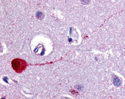 Anti-CHRM3 / M3 (Cytoplasmic Domain) Antibody