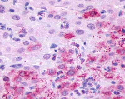 Anti-LHR / LH Receptor (C-term) Antibody