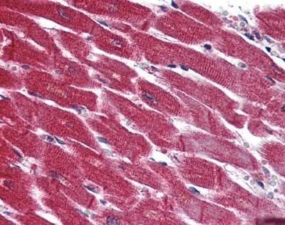 Anti-EDG3 / S1P3 (N-term) Antibody