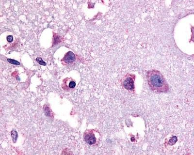 Anti-CRFR1 / CRHR1 (N-term) Antibody