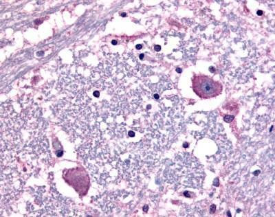Anti-CRFR1 / CRHR1 (N-term) Antibody
