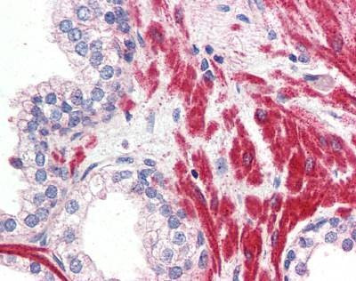 Anti-OR51E1 (Internal) Antibody