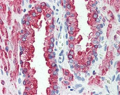 Anti-GPR146 (Internal) Antibody