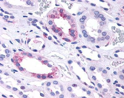 Anti-GPR146 (C-term) Antibody