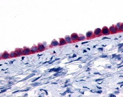 Anti-GPR133 (N-term) Antibody