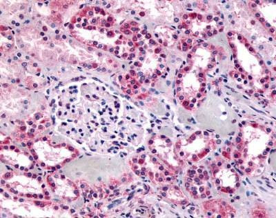 Anti-GPR91 (C-term) Antibody