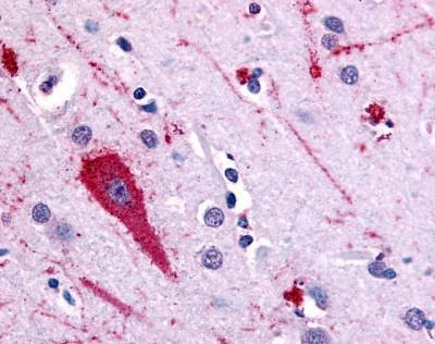 Anti-HTR5A / 5-HT5A (Extracellular Domain) Antibody