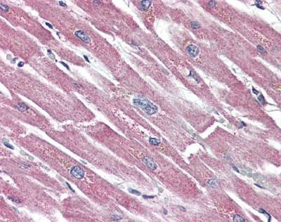 Anti-SSTR5 (Extracellular Domain) Antibody