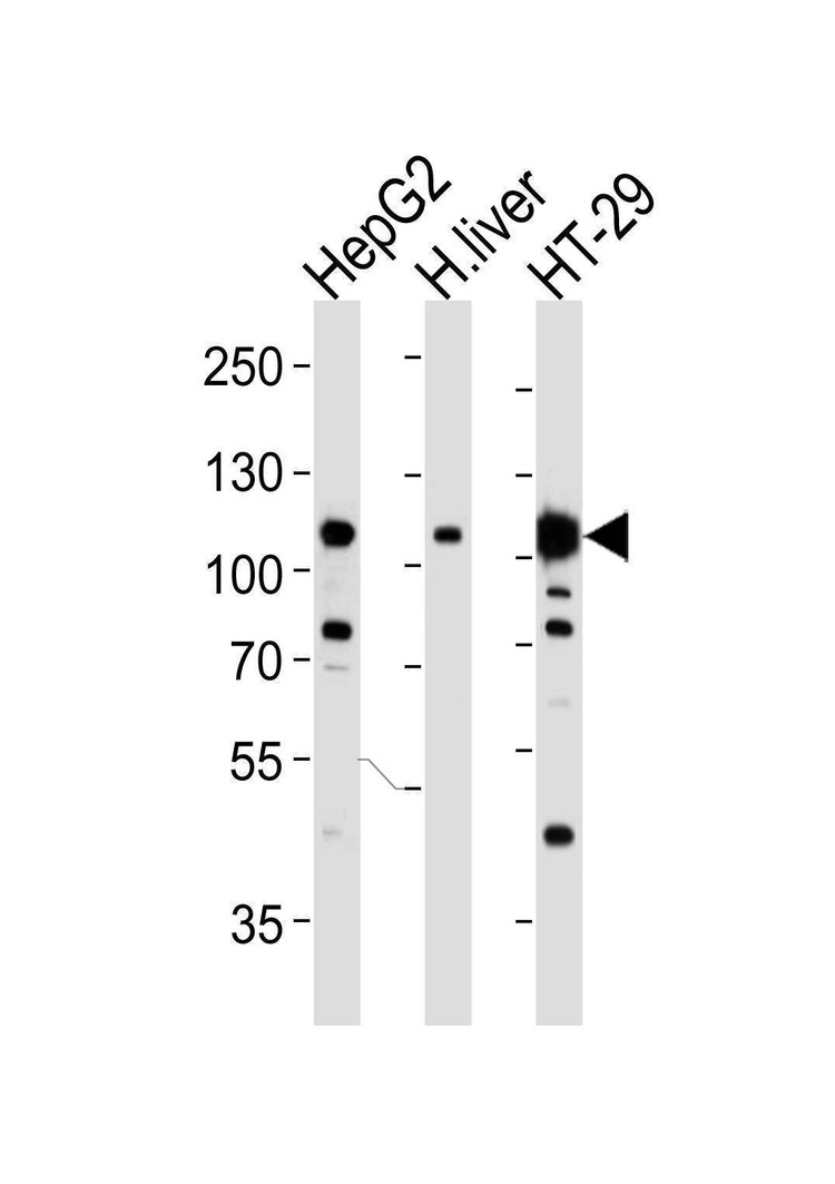 Anti-MET/HGFR Antibody