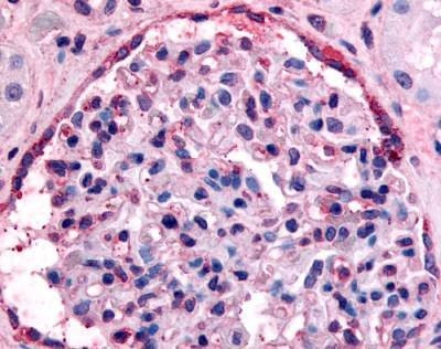 Anti-EPHA4 (C-term) Antibody