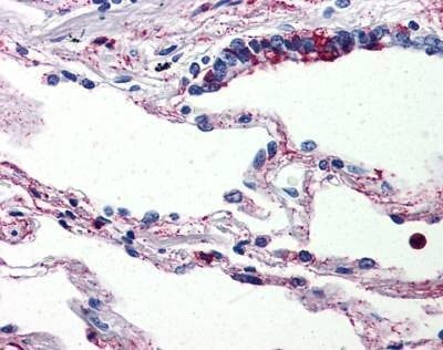 Anti-CD88 / C5A Receptor (Internal) Antibody